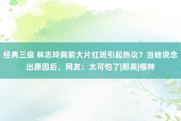 经典三级 林志玲胸前大片红斑引起热议？当她说念出原因后，网友：太可怕了|那英|模特